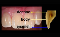 Shade taking sites for different opacities of composite